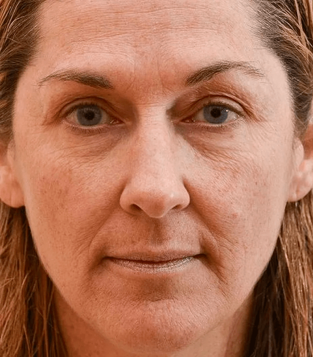 Mon visage avant l'utilisation de la crème Eudalie