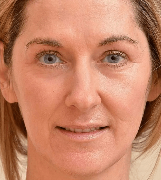 Vous avez l'air plus jeune après avoir appliqué la crème ZXCVBNQWERT