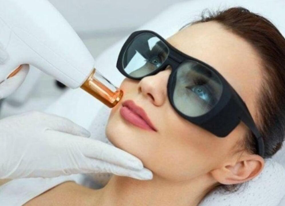 Le rajeunissement de la peau de la peau